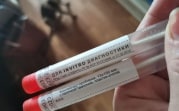 Статистика ковида за сутки в Тульской области: 181 заболевший, 6 человек умерли