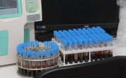 За неделю у 808 жителей Тульской области выявлен коронавирус