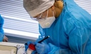 Врачи подтвердили, что коронавирус поражает мозг