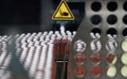 В Тульской области доплатят семьям, которые воспитывают детей с диабетом