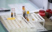 ВОЗ созовет комитет по чрезвычайным ситуациям из-за оспы обезьян