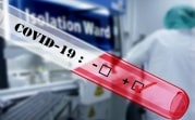 Кого в Тульской области обязаны тестировать на коронавирус