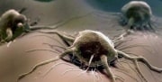 Ученые рассказали, какая пища увеличивает раковую опухоль