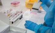 За ушедшие сутки в Тульской области выявлено 35 новых случаев заражения COVID-19
