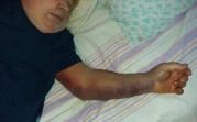 «Папа лежит связанный, ему не дают есть»: прокуратура не подтвердила факт издевательств над пенсионером в новомосковской больнице