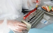 Переболевшие коронавирусом туляки смогут за деньги сдать кровь или плазму