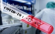 Кого в Тульской области обязаны тестировать на коронавирус