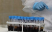 Коронавирусная статистика: в Тульской области заразились за сутки еще 231 человек