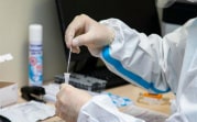 Заболеваемость гриппом в Тульской области снизилась на 16,2%